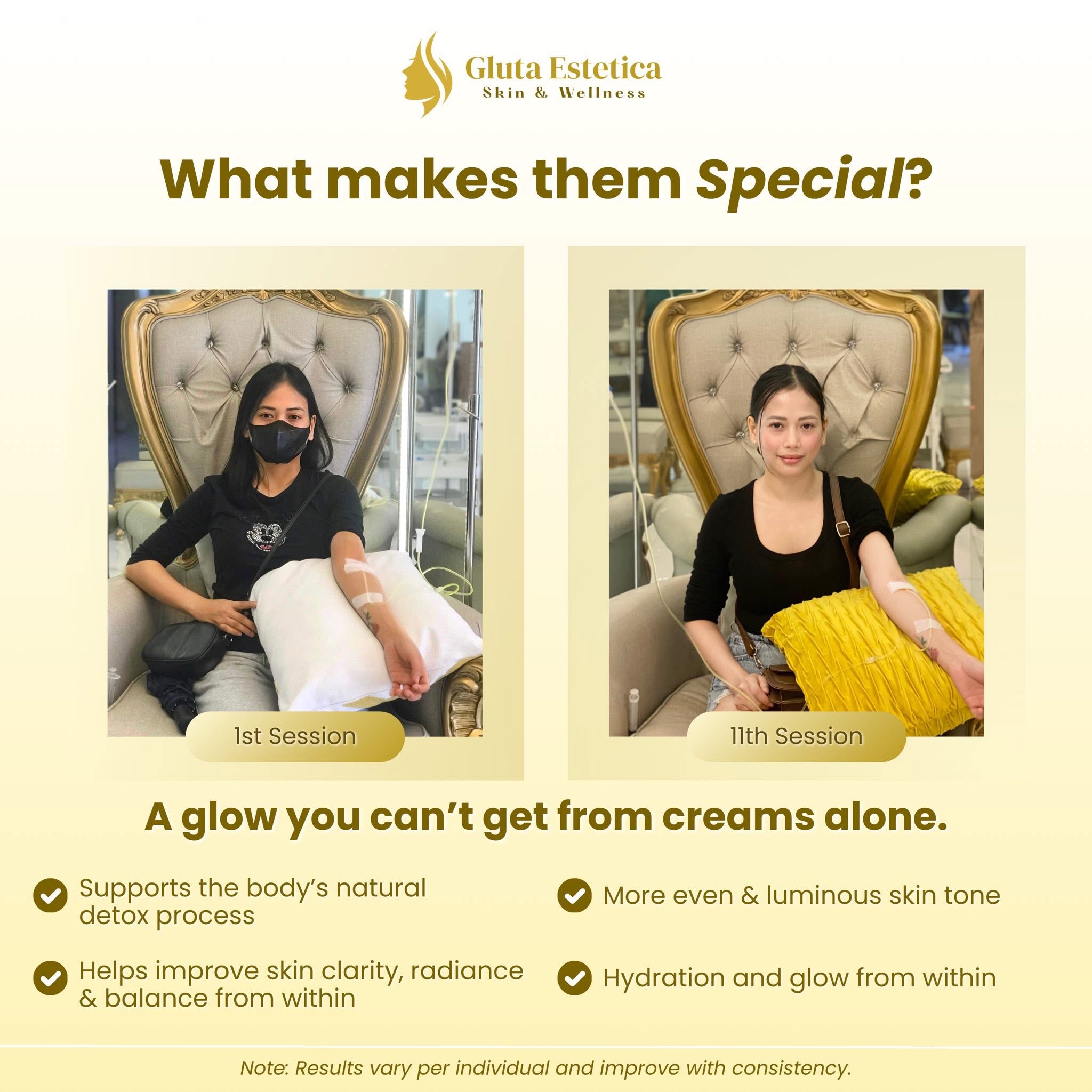 Gluta Estetica Skin & Wellness - San Fernando Branch Facebook ad: 1st Session to 11th Session, consistent glow, real…