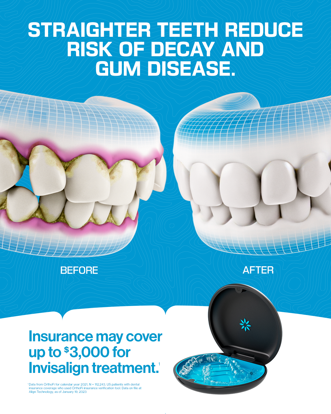 Invisalign Facebook ad