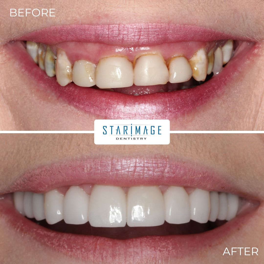 StarImage Dentistry Facebook ad