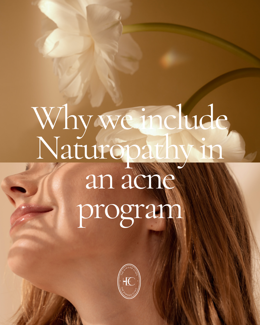 The Elwood Clinic Facebook ad: Acne doesn't always start with your skin.