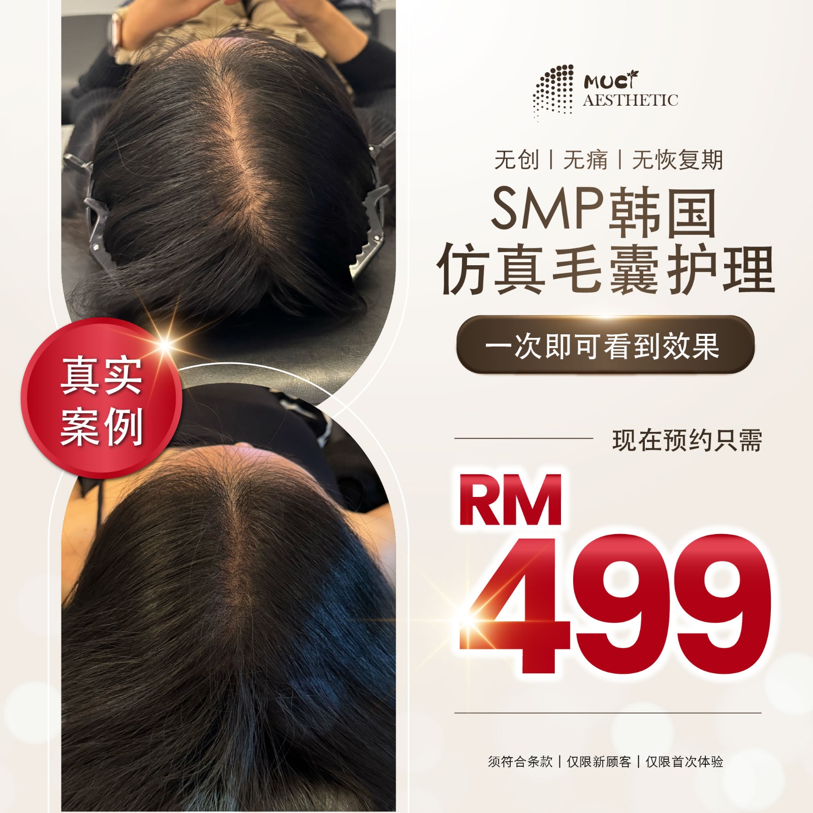 MUCI Aesthetic Facebook ad
