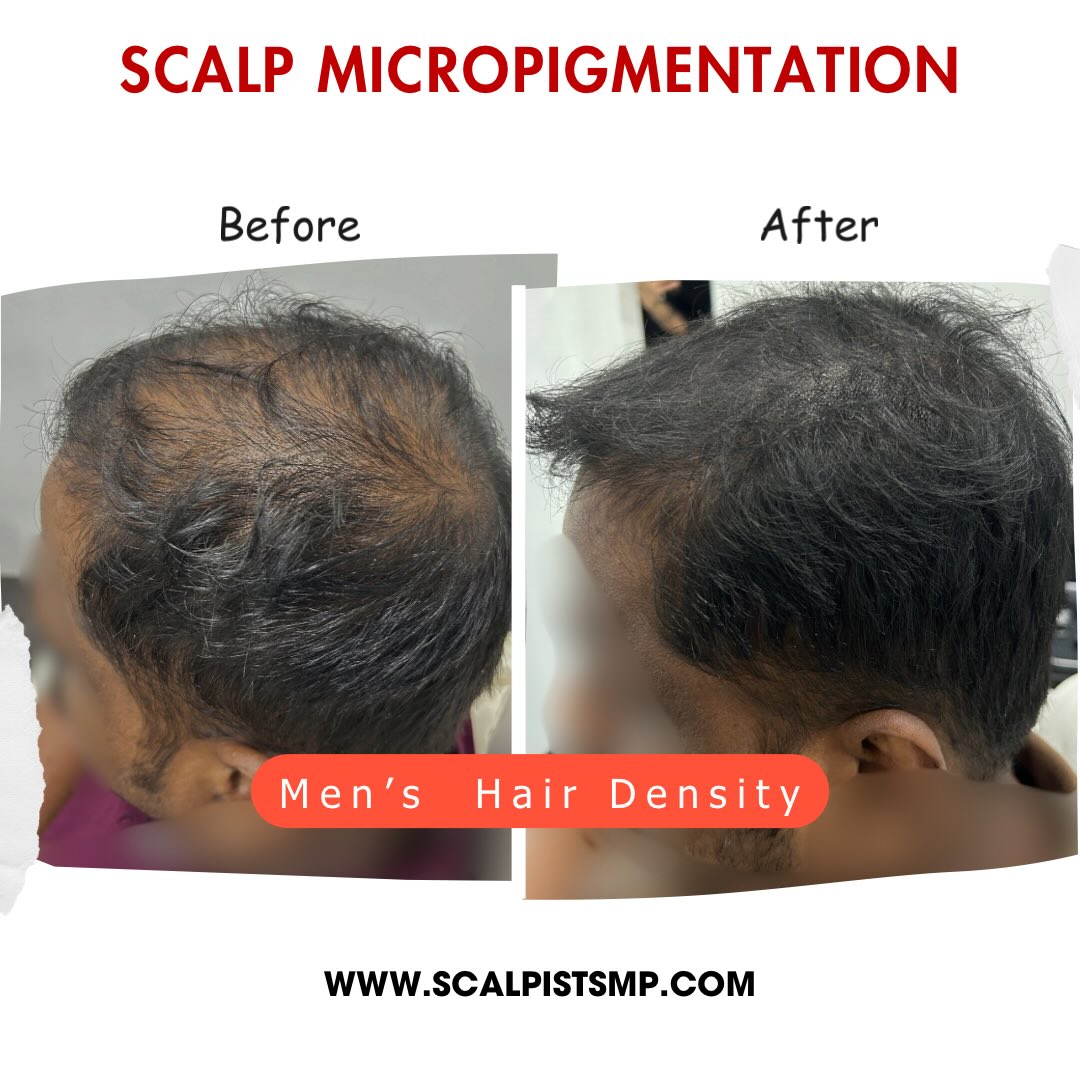 Scalpist.Smp Facebook ad