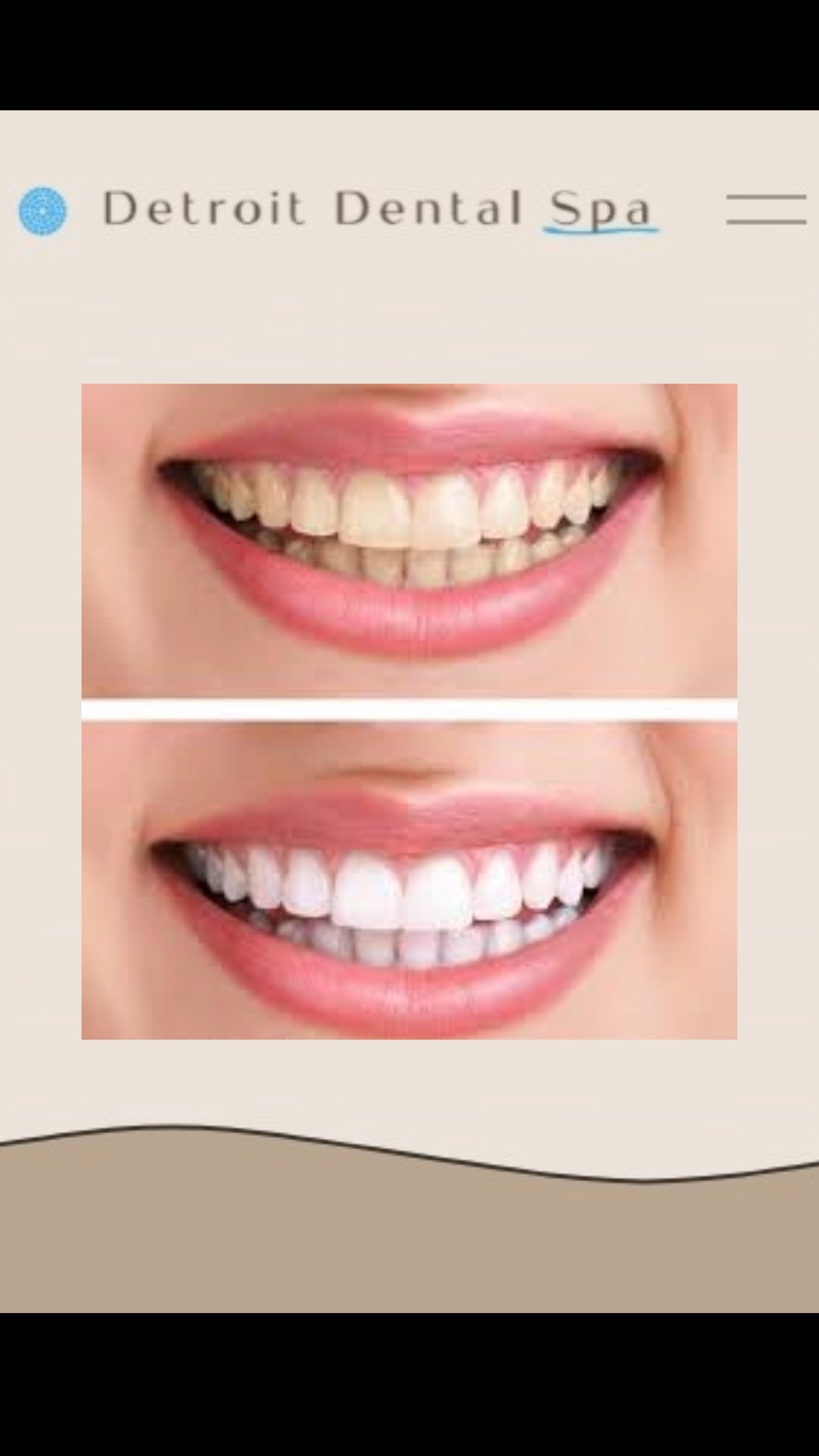 Detroit Dental Spa Facebook ad: Get Teeth Whitening your way.