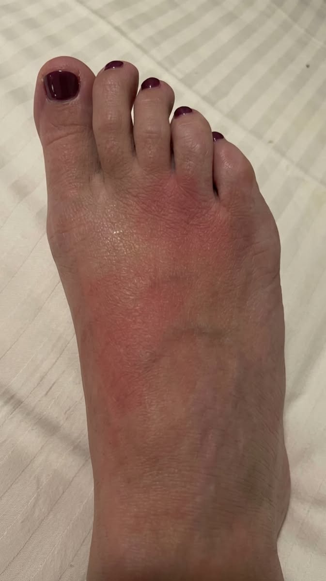 Jennifer Thompson Facebook ad: The burning in you feet isnt a foot problem!