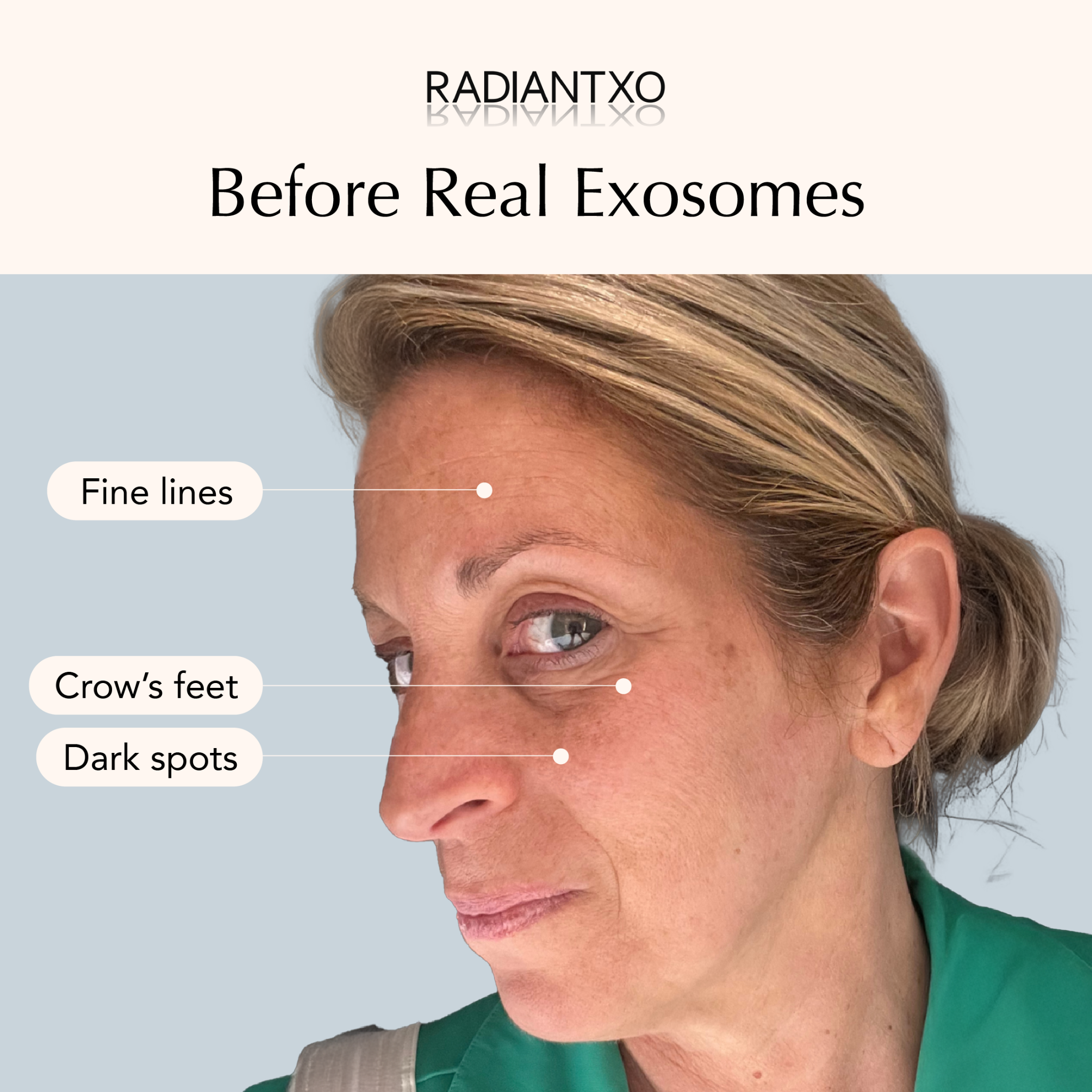Radiant XO  Facebook ad