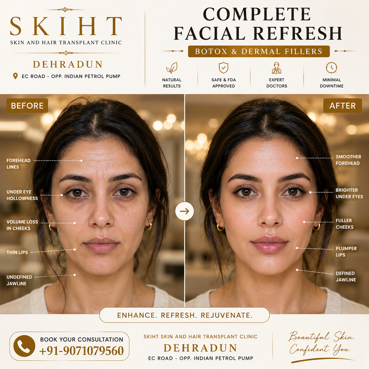 SKIHT - Skin & Hair Transplant Clinic Dehradun Facebook ad: SKIHT - Dehradun's #1 Skin & Hair Transplant Clinic…