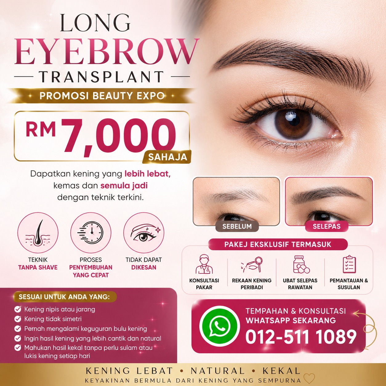 Hair Transplant Malaysia Facebook ad