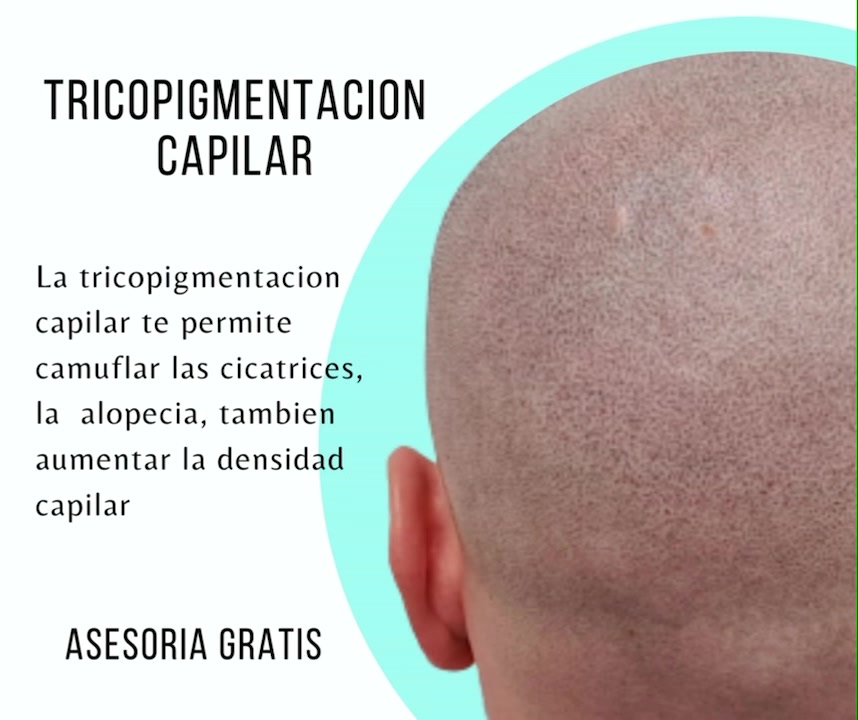 Adhara Esthetic Facebook ad: Libérate de complejos y empieza a disfrutar de…