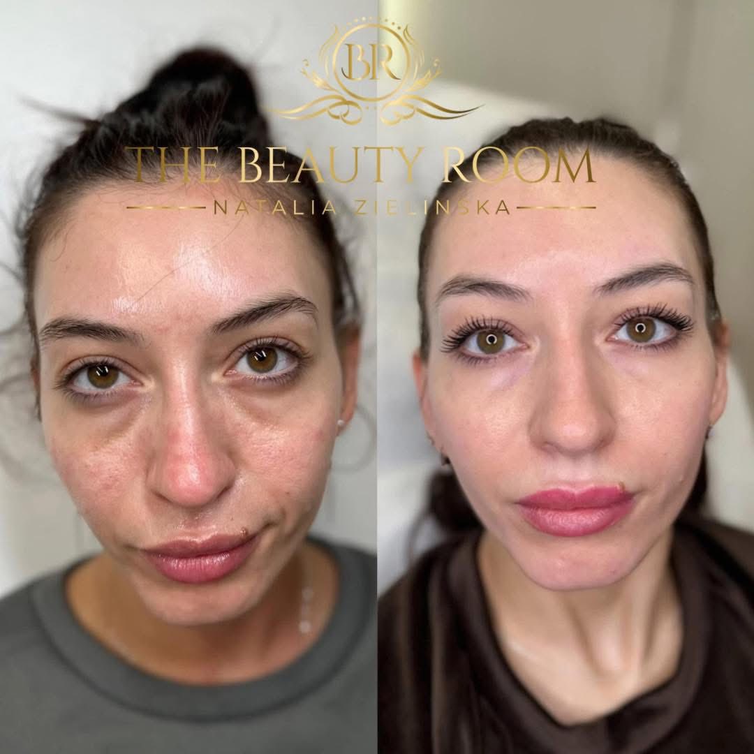 The Beauty Room Facebook ad: WHAT ARE SKIN STIMULATORS?