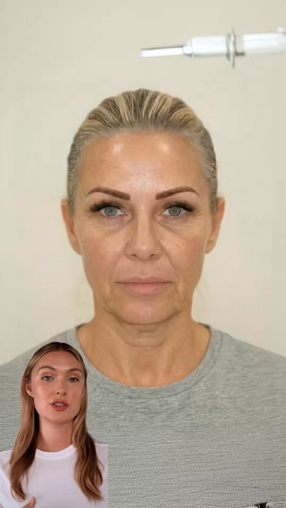 Bea - Aesthetic Treatments AI Facebook ad: AI beauty analysis + treatment preview