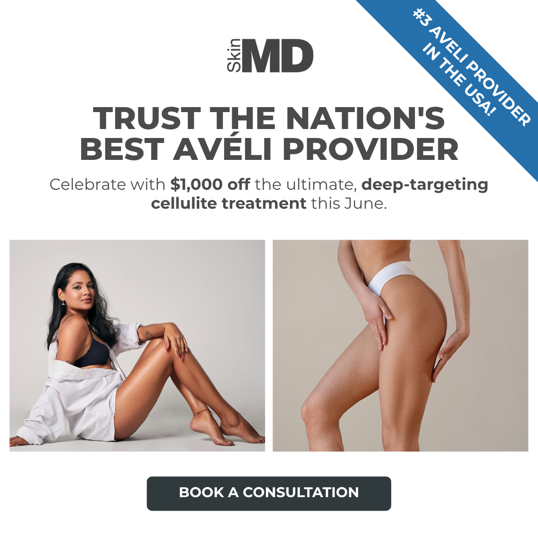 Skin MD Facebook ad: Save $1,000 on Avéli