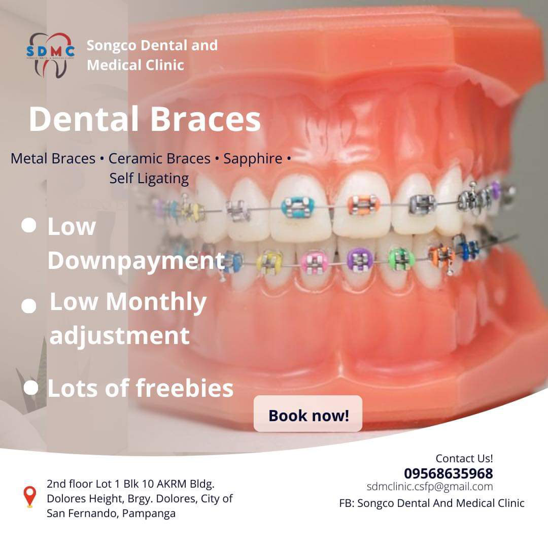 Songco Dental and Medical Clinic - Dolores Facebook ad