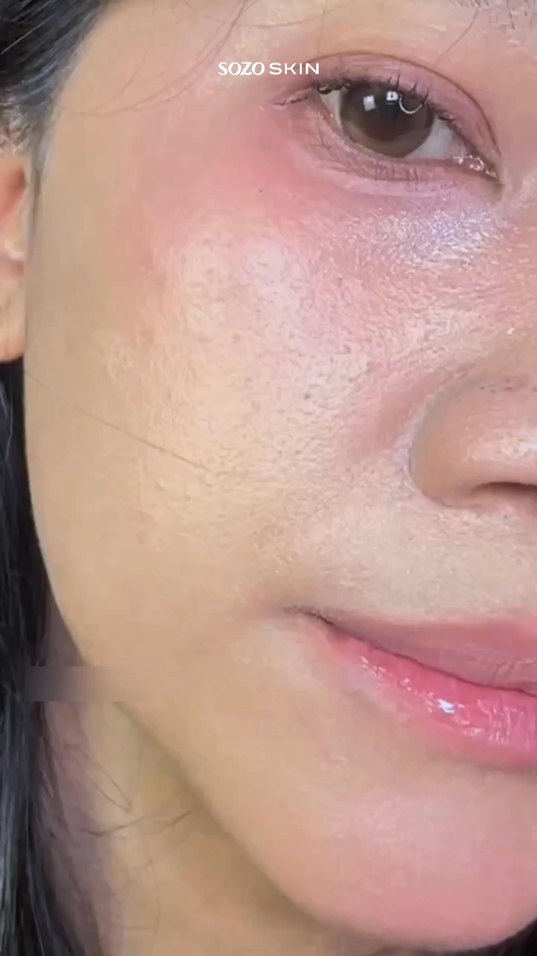 Sozo Skin Clinic Facebook ad: Cari tahu Sozo Clinic