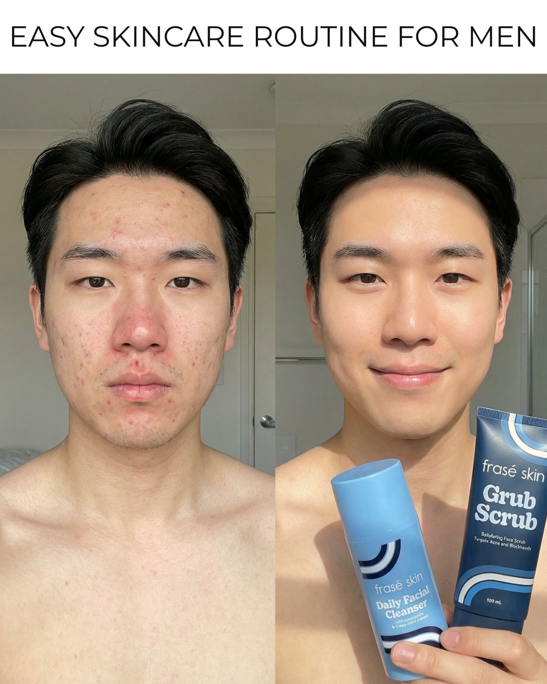 Frasé Skin Facebook ad