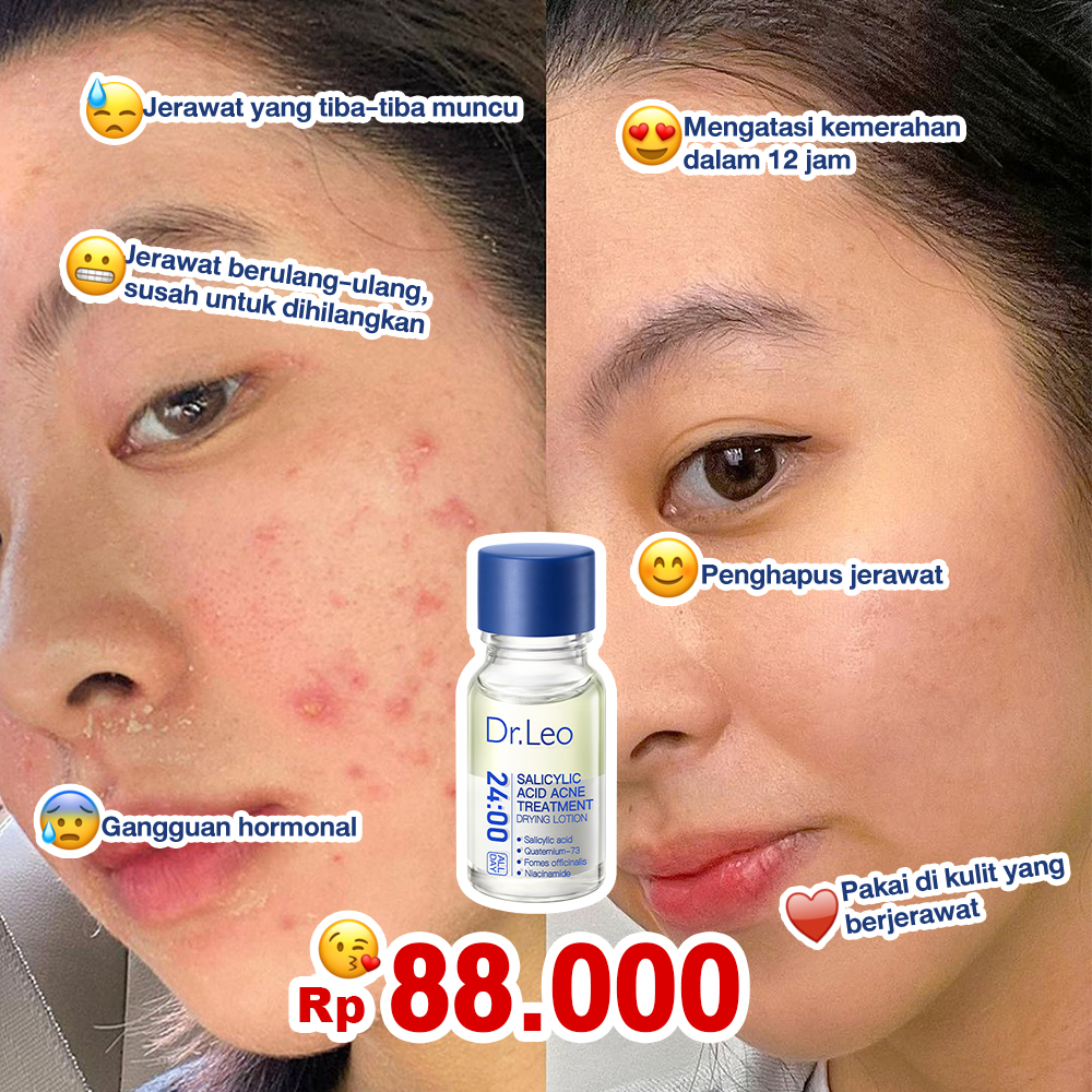 Dr.Leo indonesia Facebook ad: Glow with Dr. Leo's Salicylic Acid Essence.