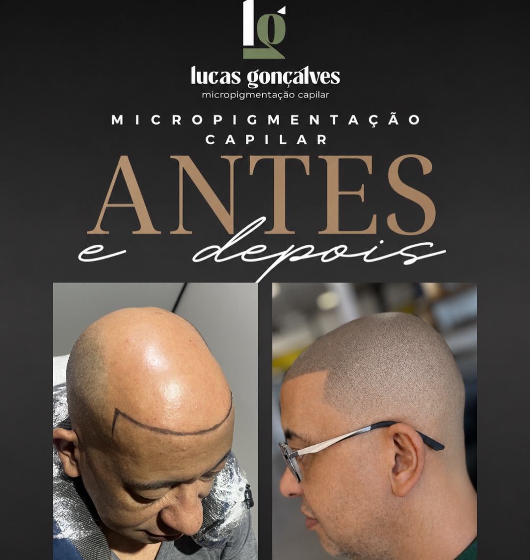 Lucas microcapilar Facebook ad: A diferença está nos detalhes.