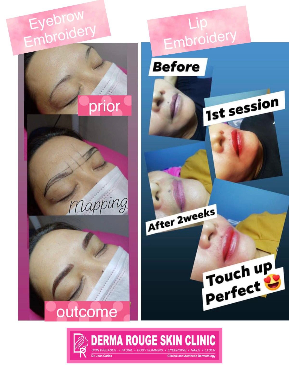 DeRma Rouge Skin Clinic Pampanga and Tarlac Facebook ad: 70% OFF