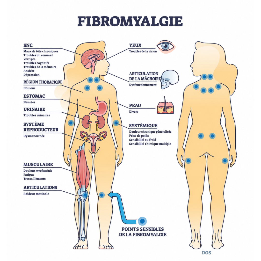 Confort Fibromyalgie France Facebook ad: À lire si la fibromyalgie vous vole votre vie