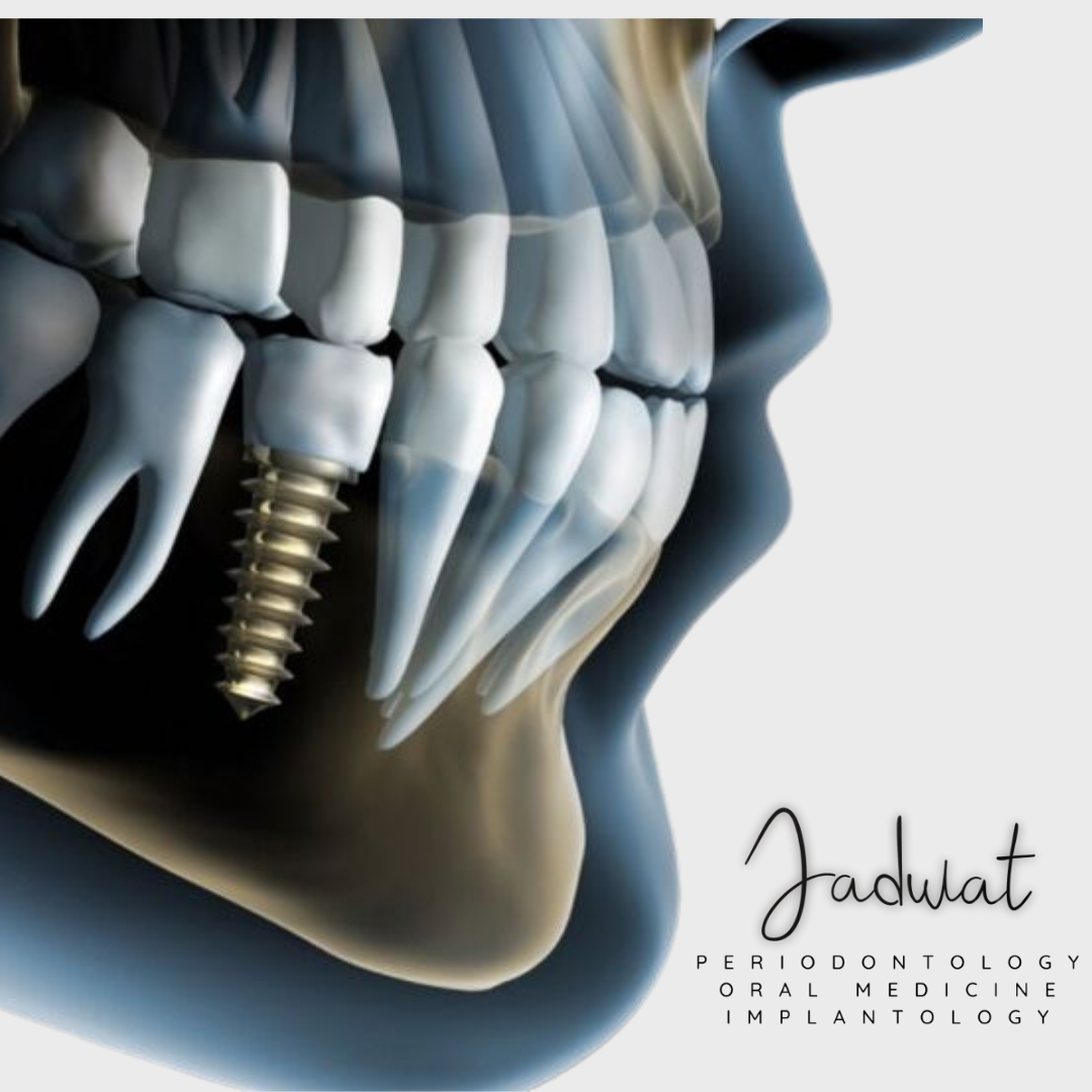 Dr. Jadwat - Periodontology & Implantology Facebook ad: What We Offer at Dr.