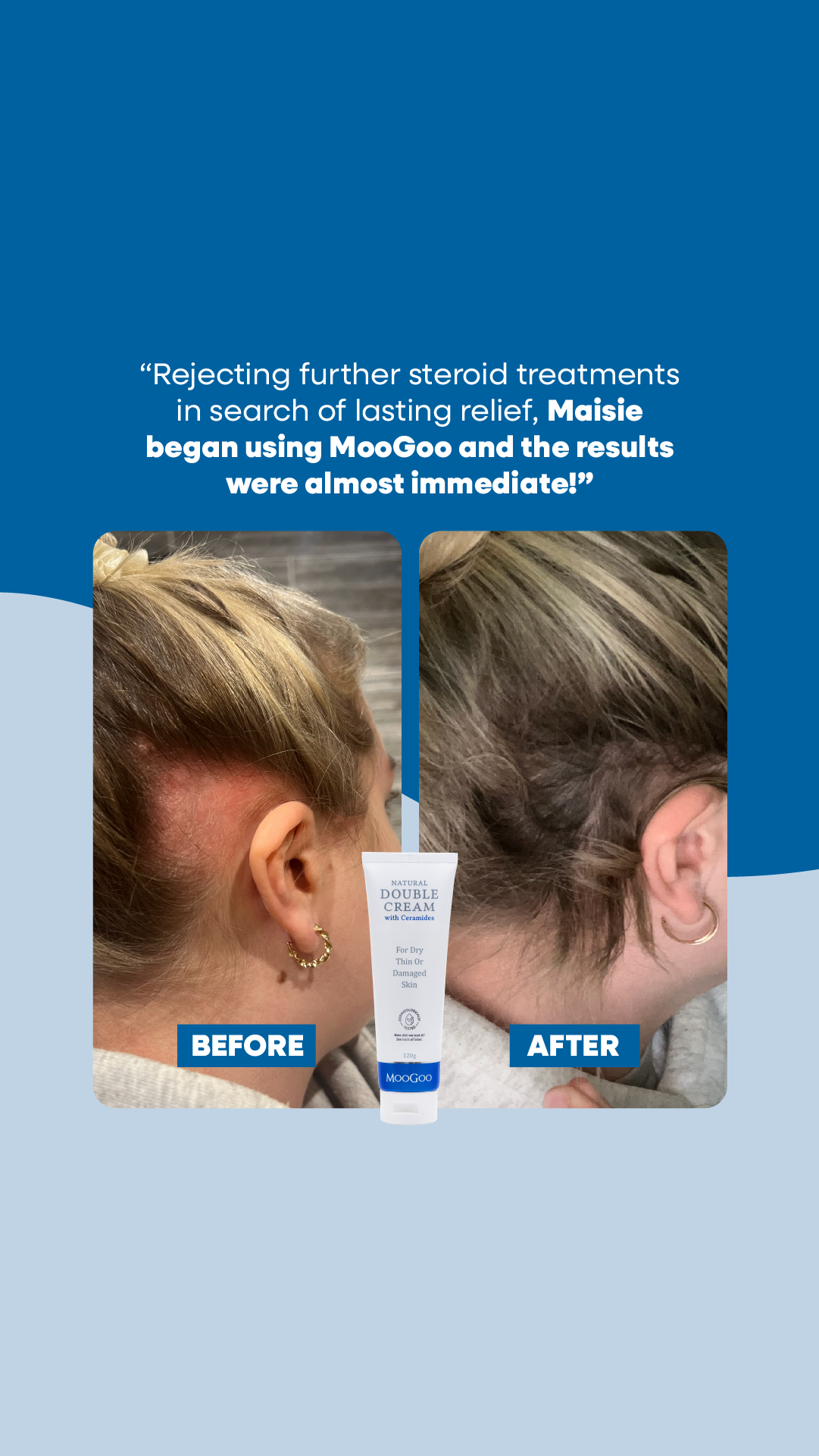 MooGoo Skin Care Facebook ad