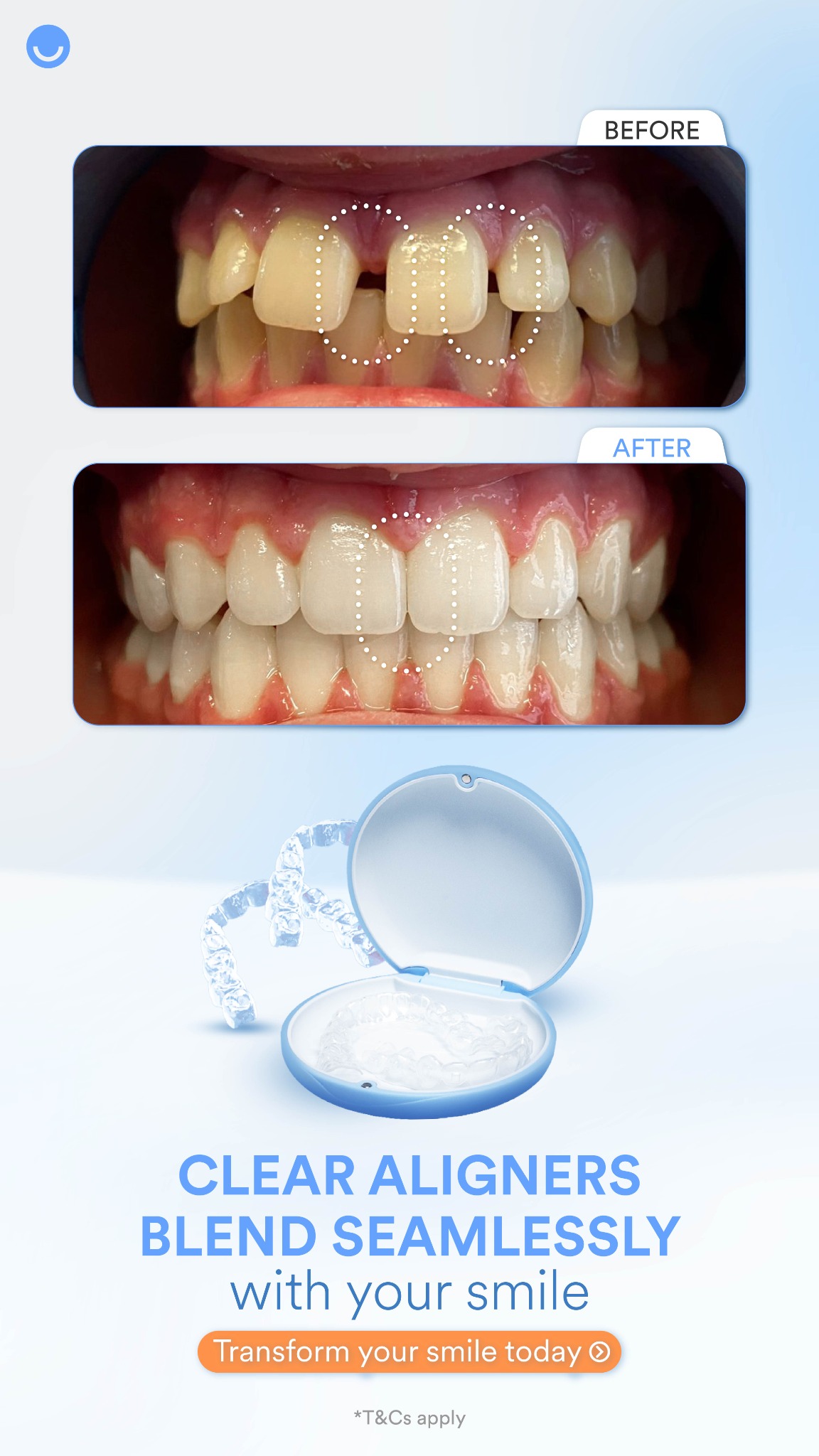 Dr. Wondersmile Facebook ad from Jul 23, 2026