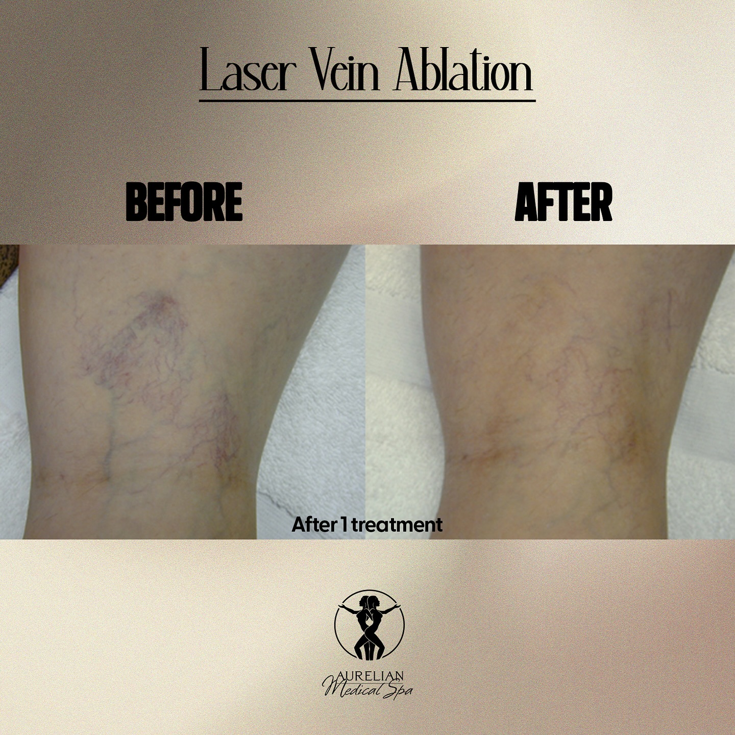 Aurelian MedSpa Facebook ad