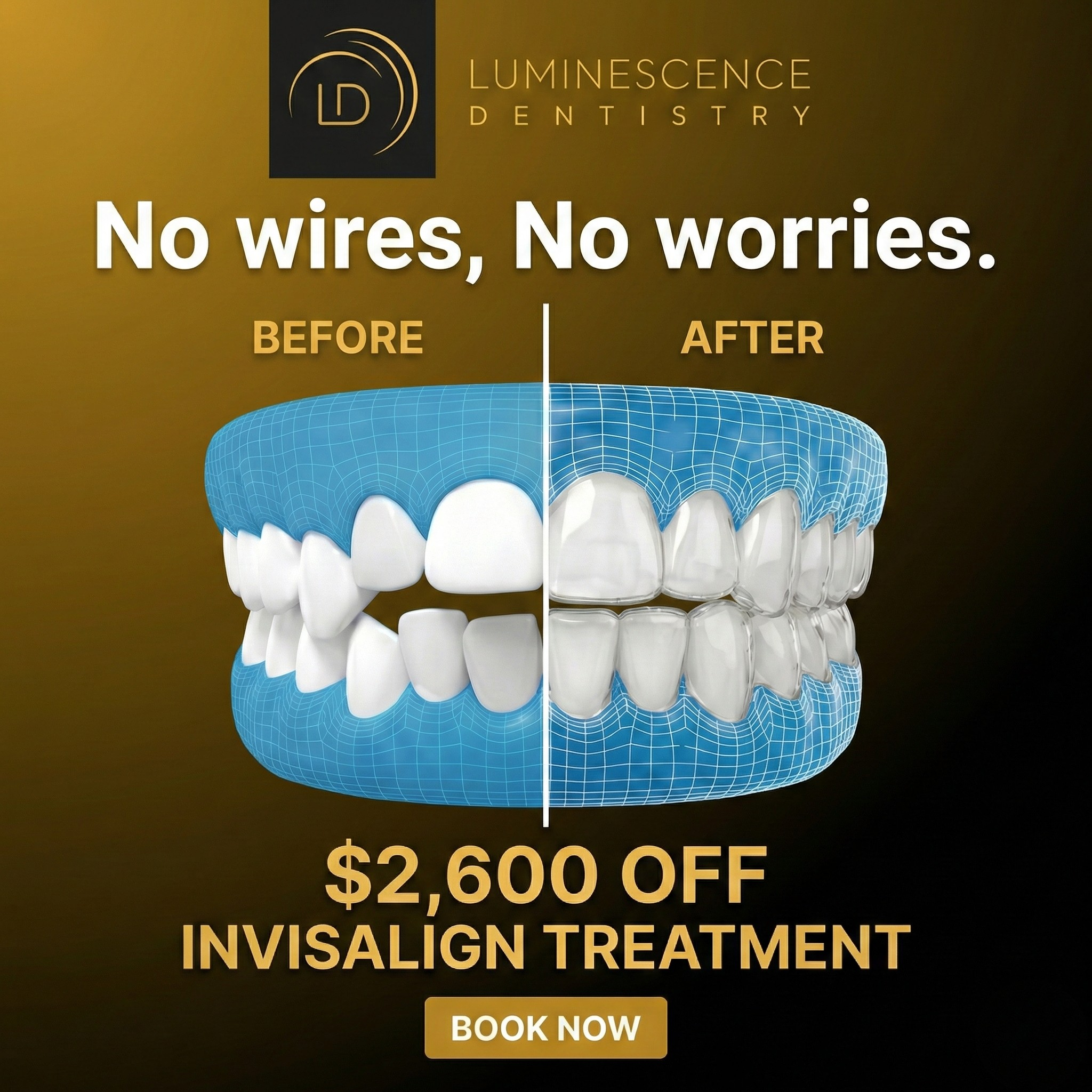Luminescence Dentistry Facebook ad