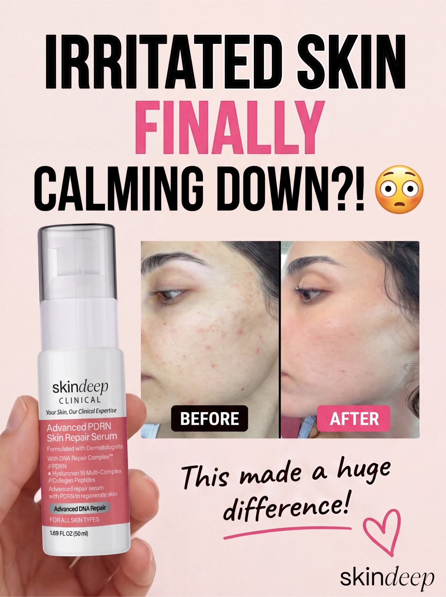 Skin Deep Facebook ad