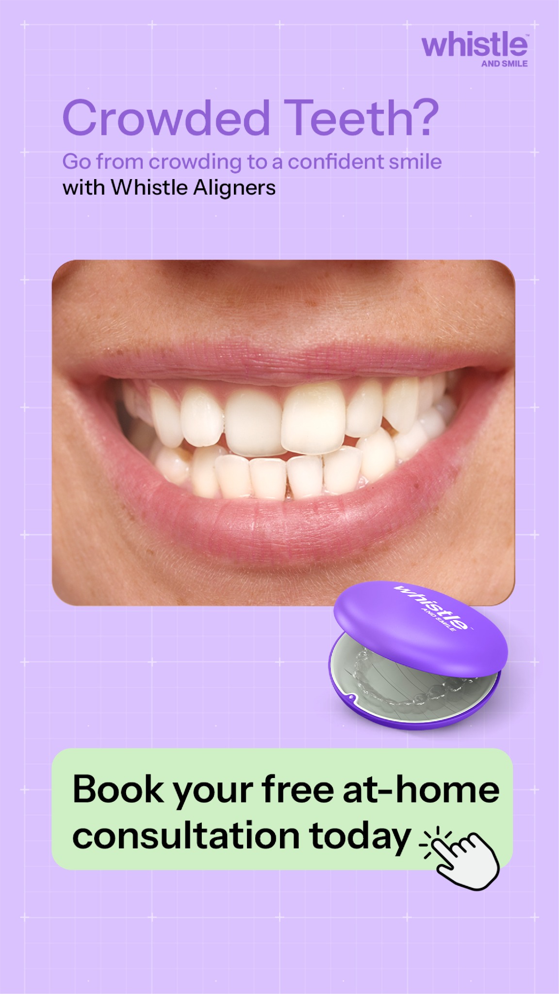 Whistle.in Facebook ad from May 11, 2026
