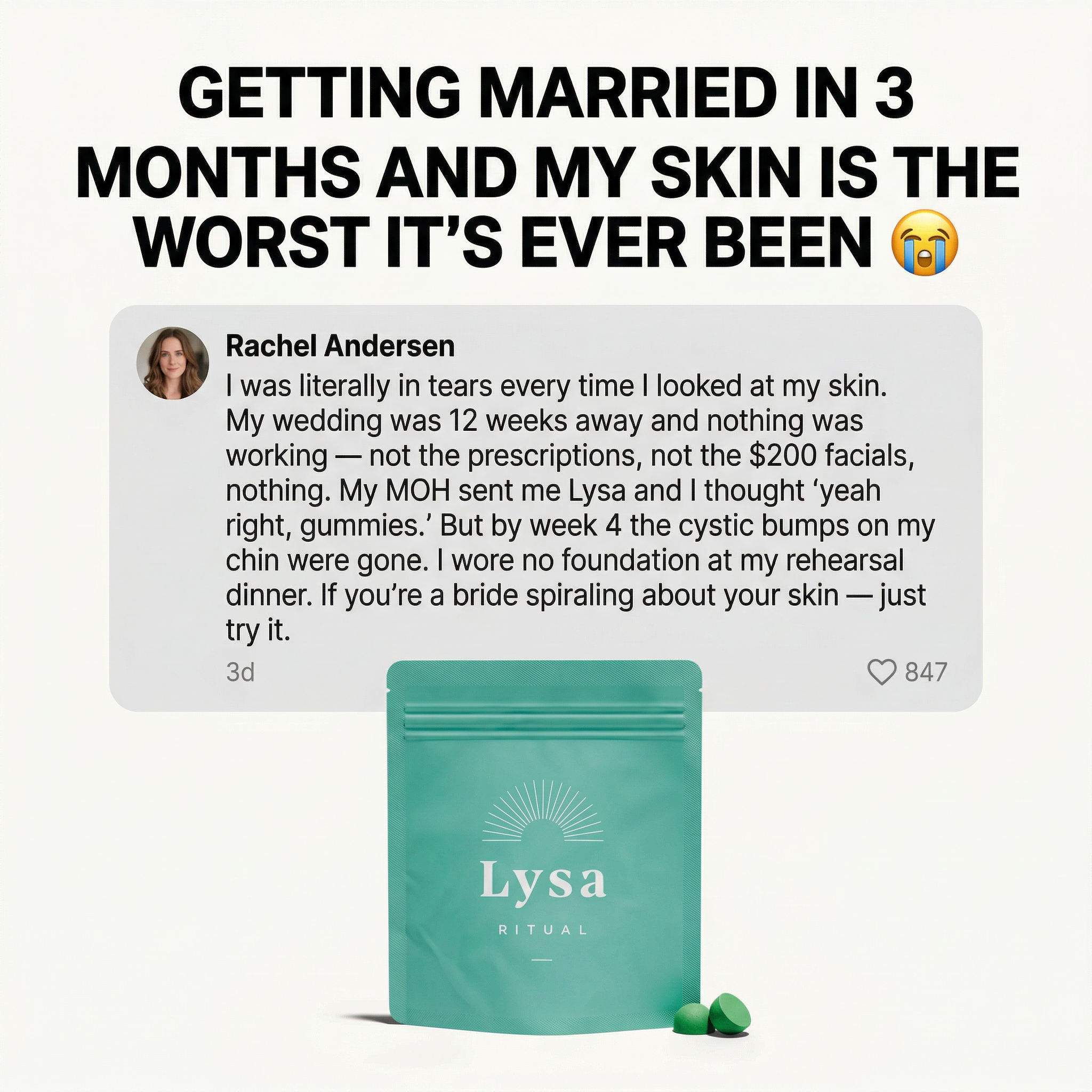 Lysa Ritual Facebook ad: Wedding with ACNE!?