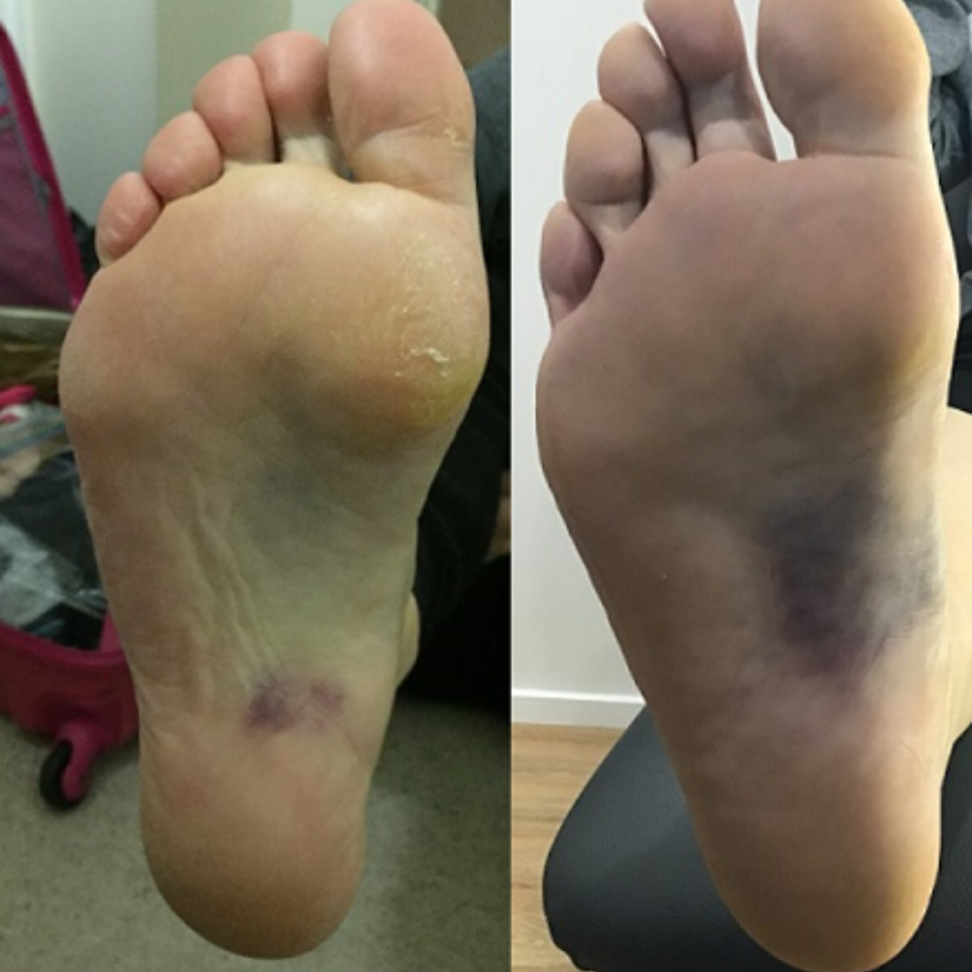 American Foot Association - AFA Facebook ad: If your first step out of bed hurts, you’re re-injuring…