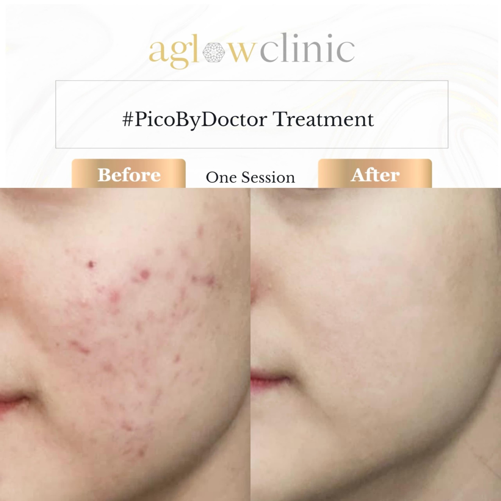 Aglow Clinic Facebook ad