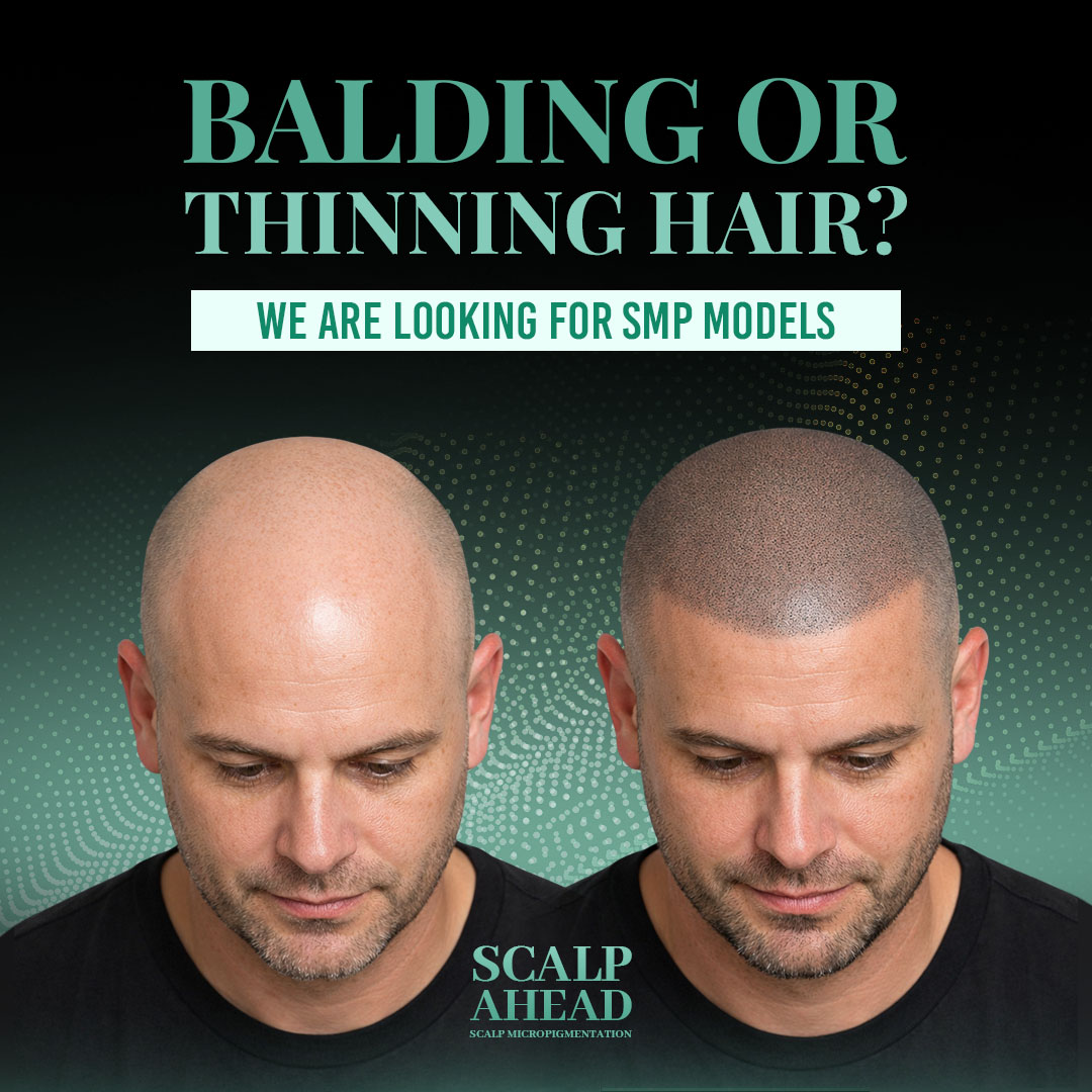 Scalp Ahead  Facebook ad