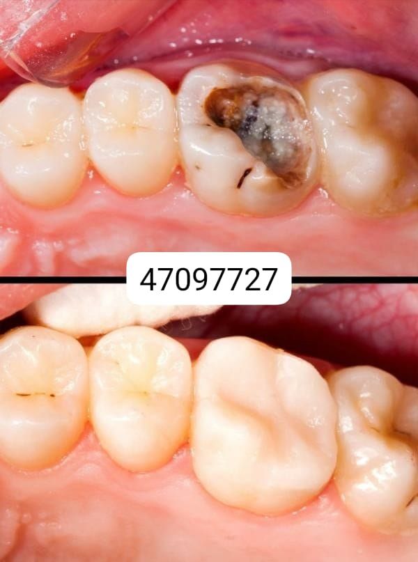 Hôpital clinimed dentiste002 Facebook ad: Konsiltasyon GRATIS pou semèn sa a!