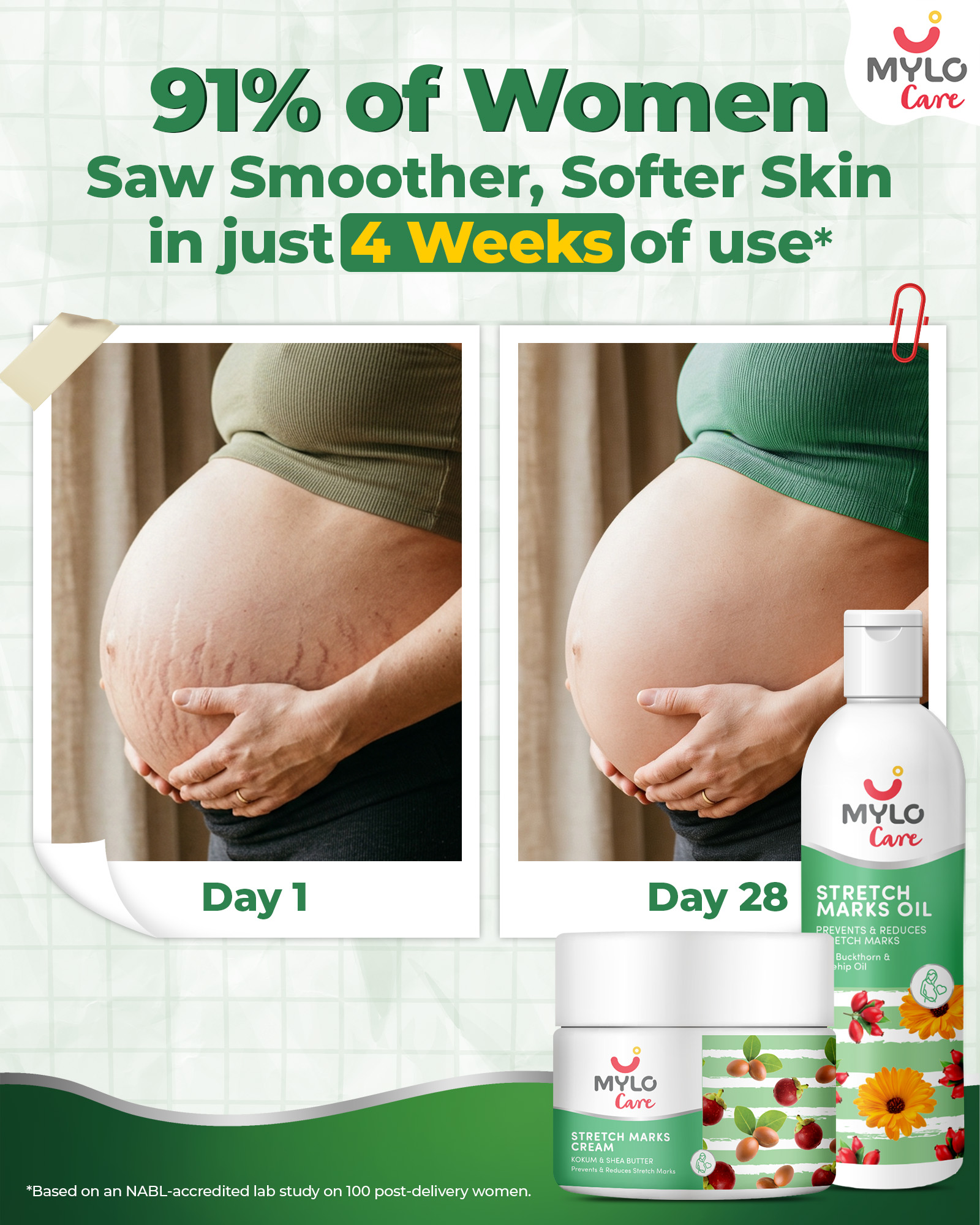 Mylo Care Facebook ad