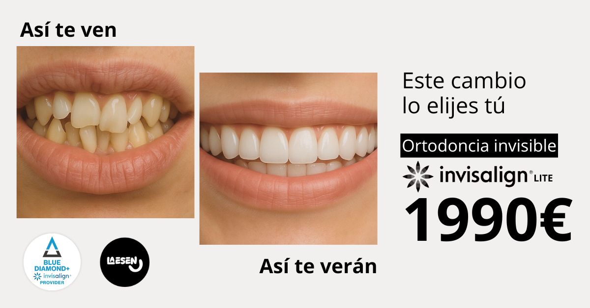 Ortodoncia Invisible L A E S E N Facebook ad: Precio cerrado desde el primer día