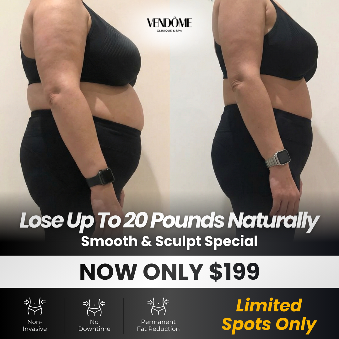 Vendome Clinique & Spa Facebook ad from Mar 16, 2026