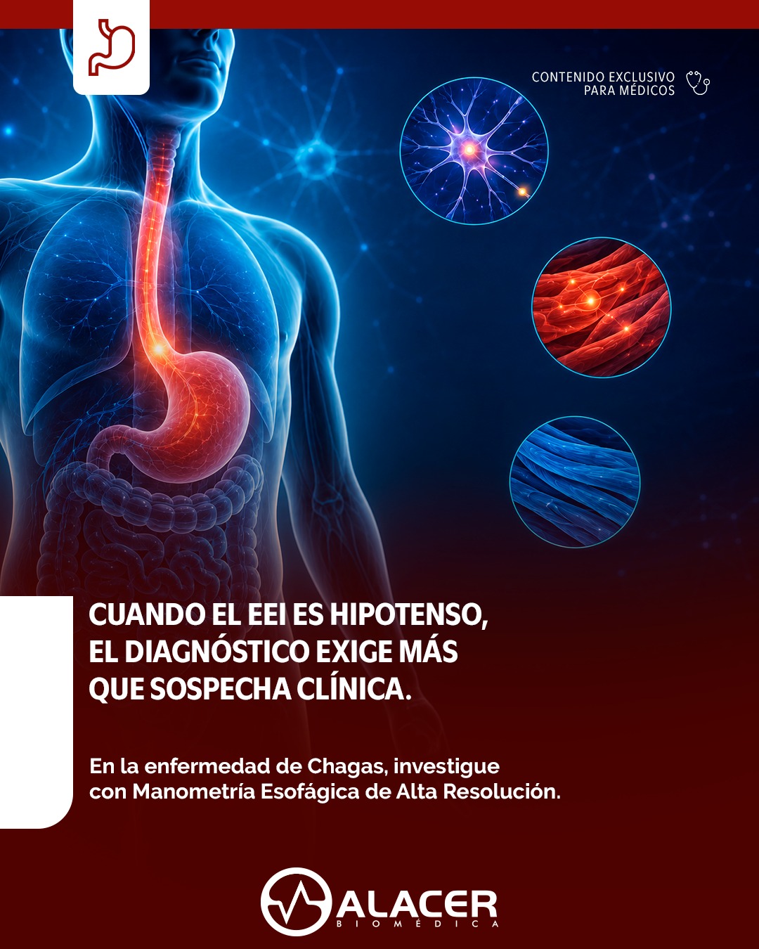 Alacer International Facebook ad: En la acalasia chagásica, la fisiopatología puede generar…