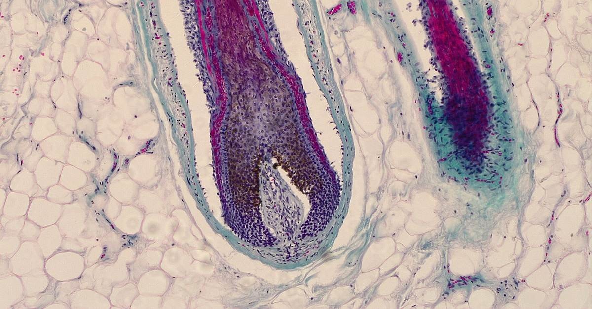 Doctors Health Hub Facebook ad: Is Enhanced Cellular Tissue Healing the Right Choice?
