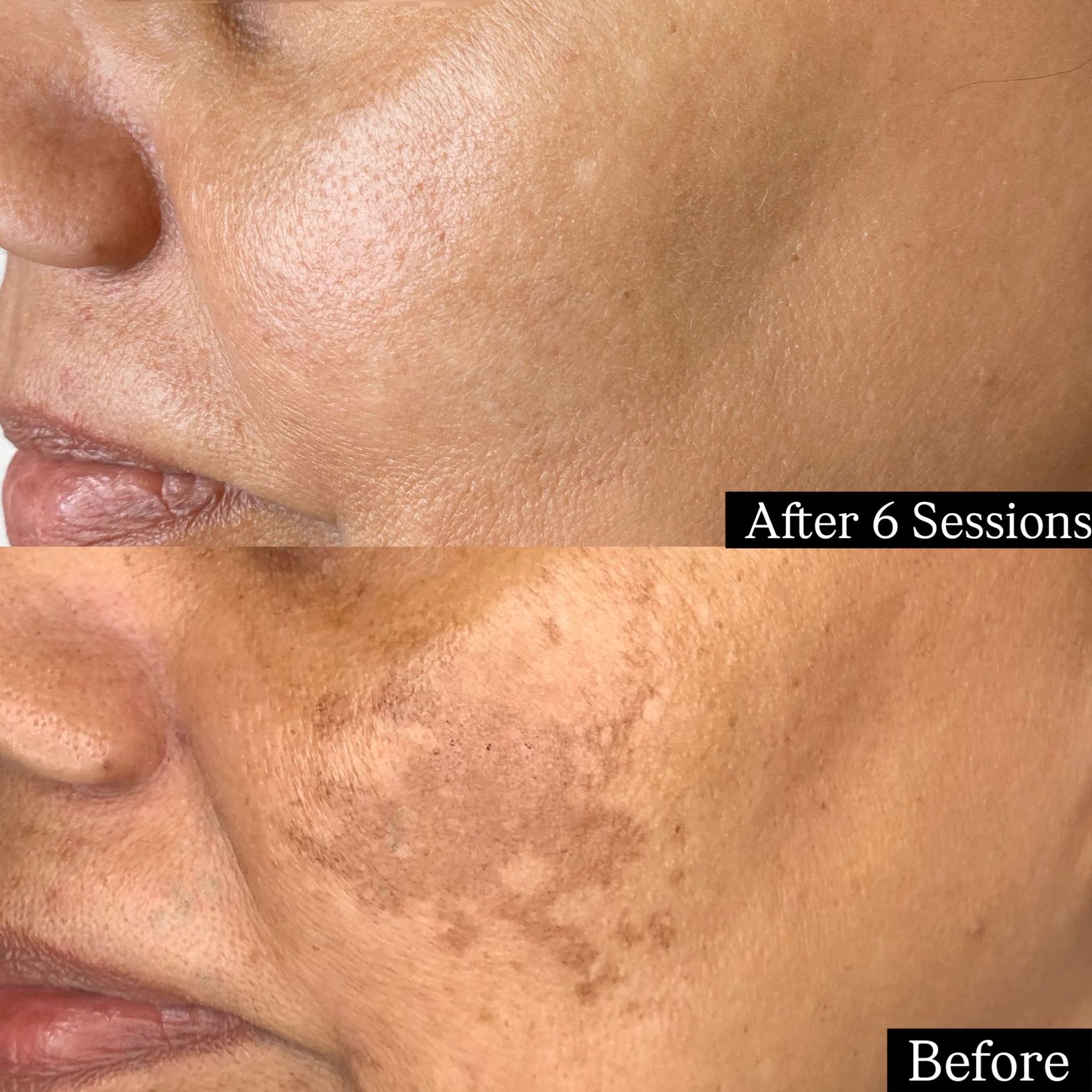 Lanree Aesthetics Facebook ad: Instagram