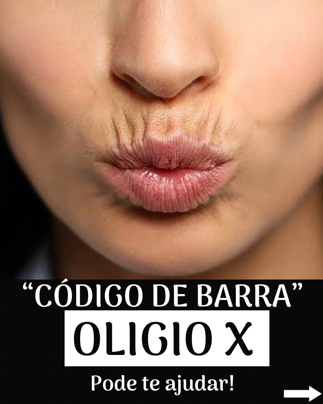Clínica Dra. Andréa Pimentel Facebook ad: Tired of those fine lines around your mouth?