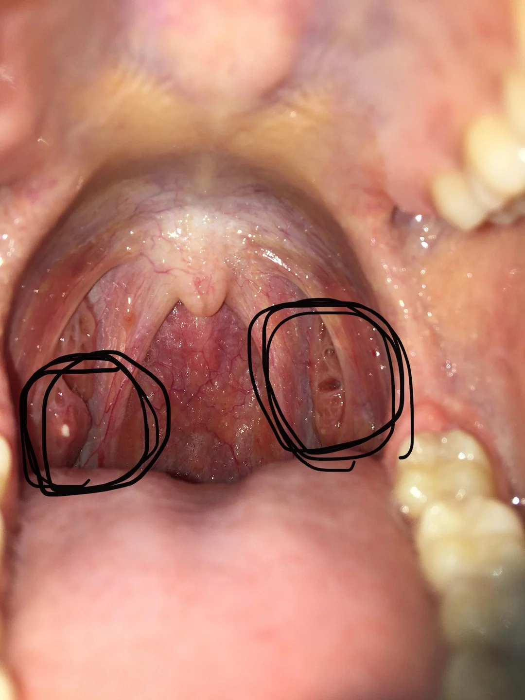 Nuviway Facebook ad: Should you get tonsillectomy?