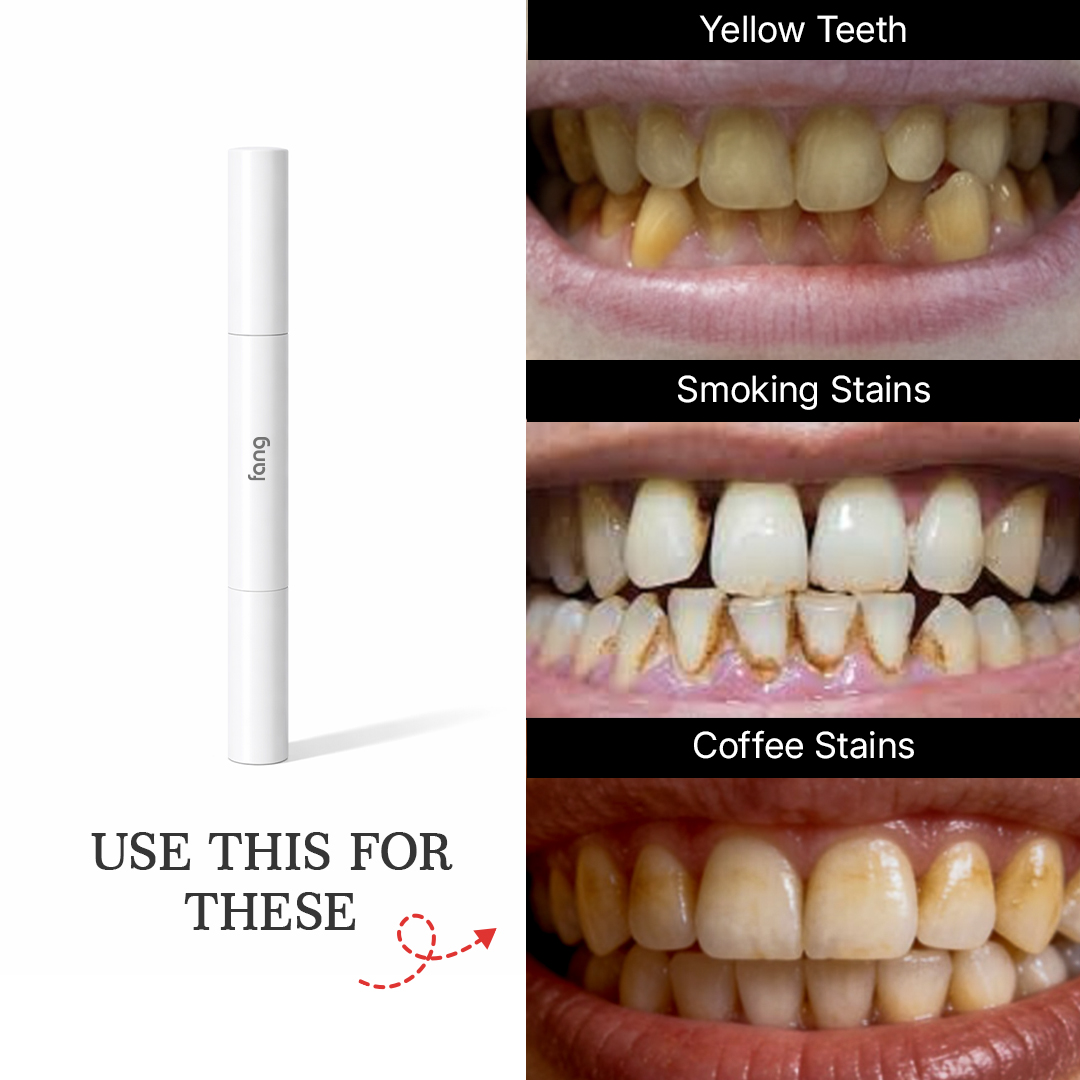 Smile Care Club Facebook ad