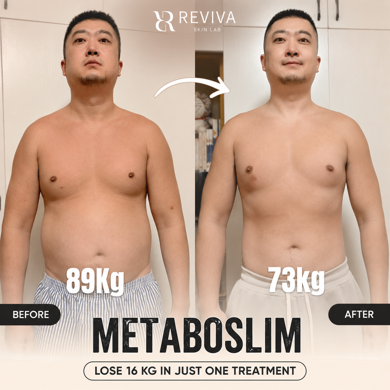 Reviva Aesthetic & Beauty Clinic - Iloilo Branch Facebook ad: Discount 40% First 10 Customers Only