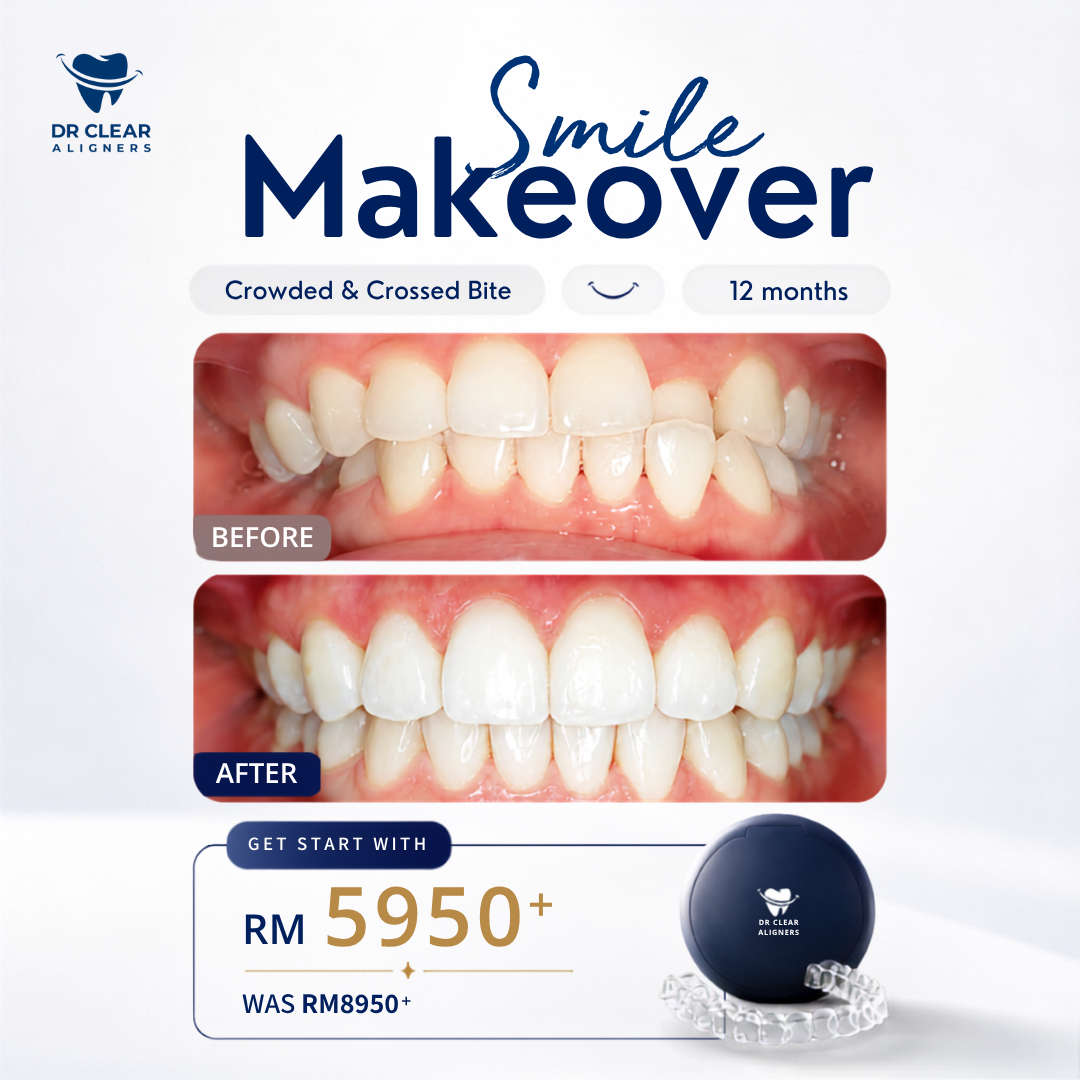 Dr Clear Aligners MY Facebook ad
