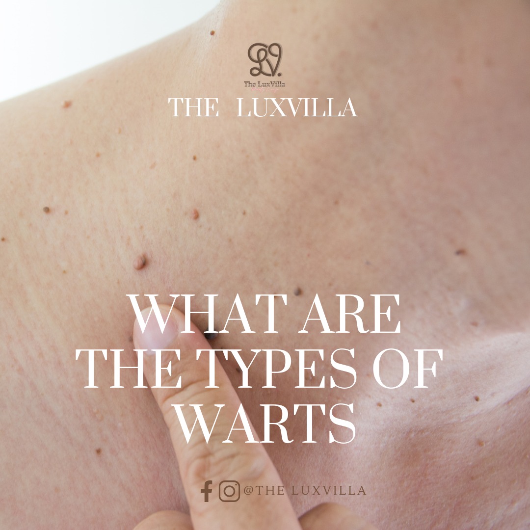 The Luxvilla beauty clinic Facebook ad