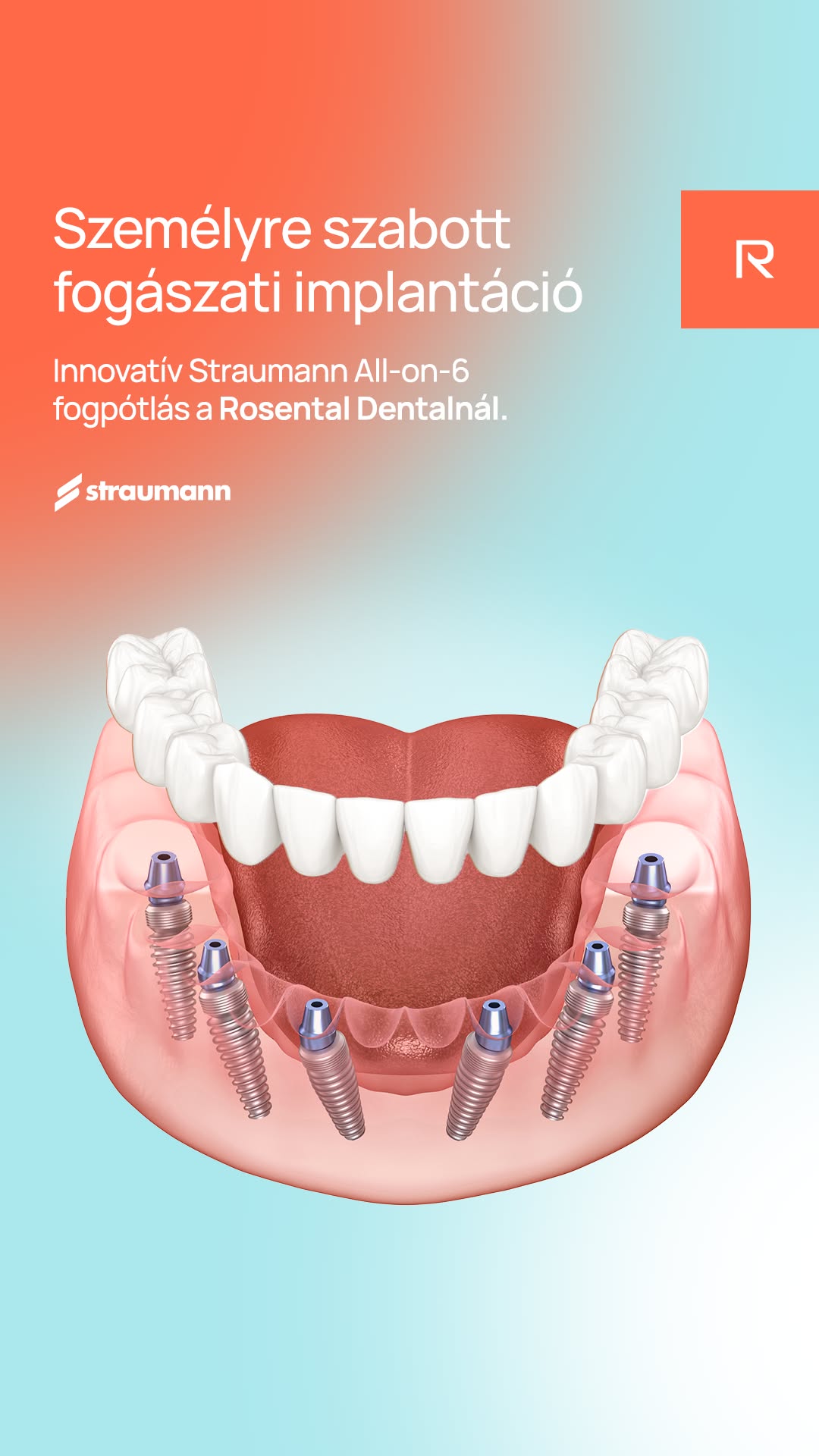 Rosental Dental Facebook ad
