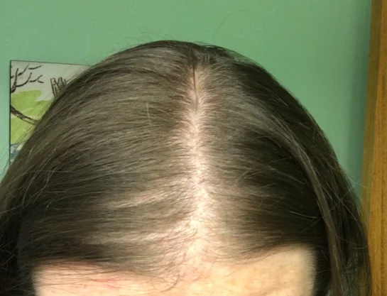 Cassie McCarthy Facebook ad: My sister's perimenopause hair loss stopped in 3 months…