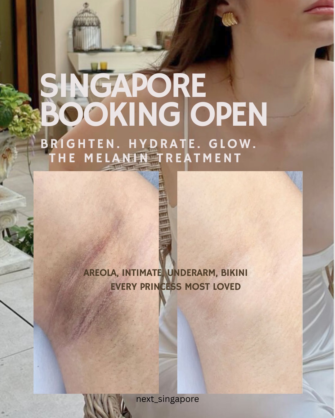 Next 1st Korea Scalp Micro-Pigmentation Facebook ad: Melanin Care you can trust, by NEXT