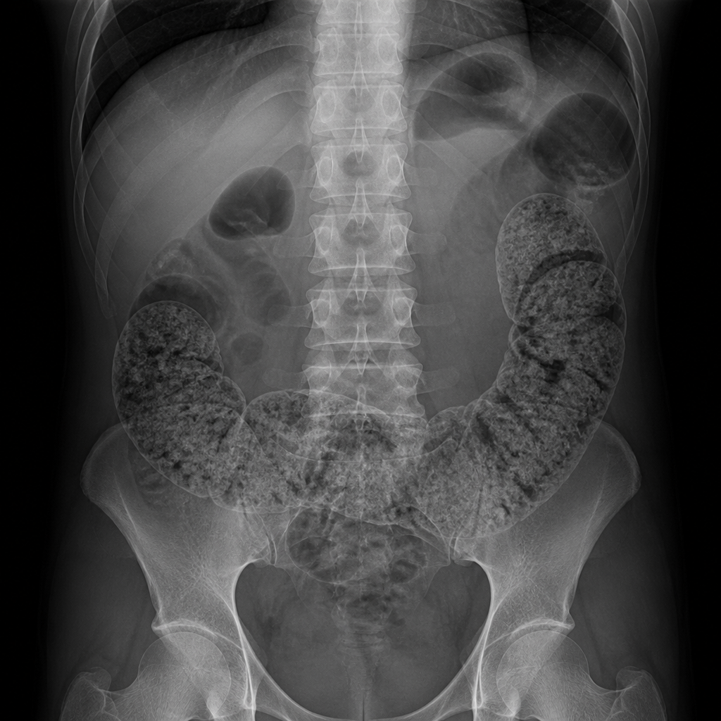 Living Well with Diana Facebook ad: The Secret Hormone Behind Constipation